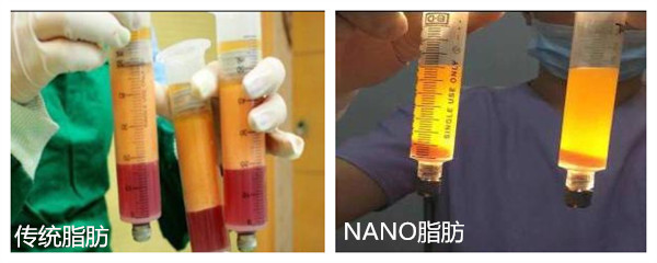 脂肪對(duì)比.jpg