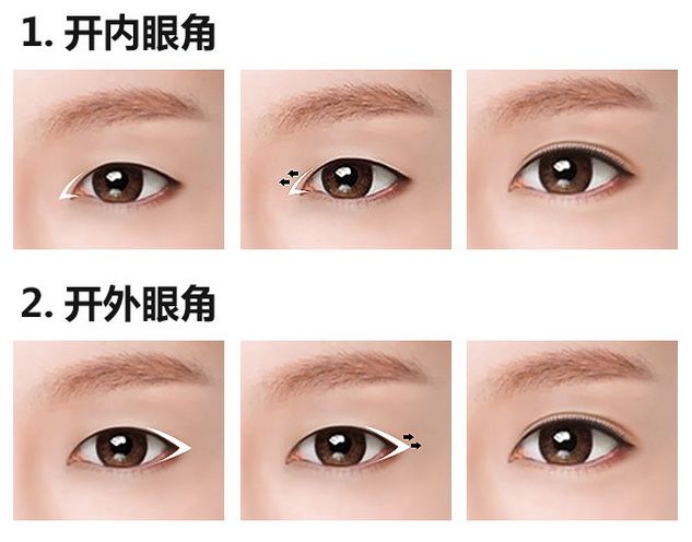 開(kāi)內(nèi)眼角.jpg
