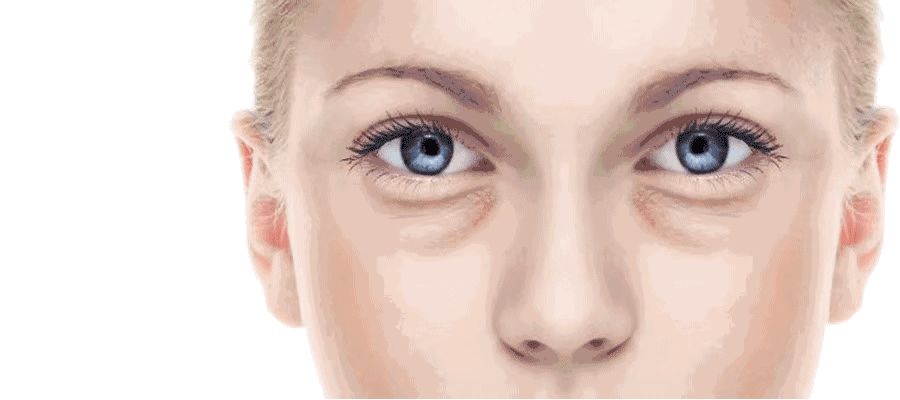 去眼袋動(dòng)圖