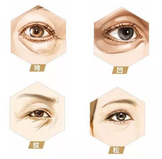 祛眼袋.jpg