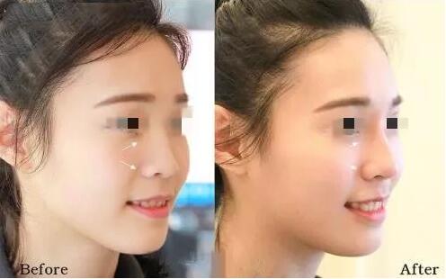 情人節(jié)活動-海南整形4